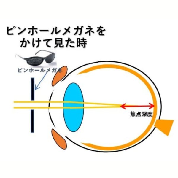 ピンホールメガネの効果